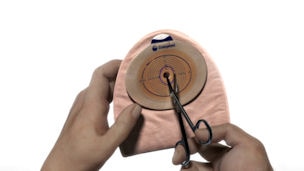 Stoma video guides