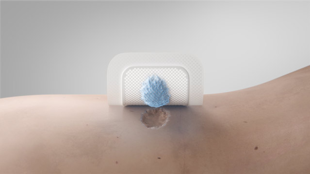 Unique 3D foam structure for superior absorption