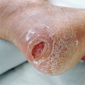 Wound And Skin Condition