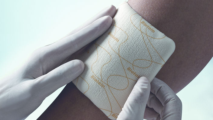 Wounds with extra fragile skin