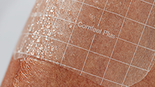 Transparency for wound inspection