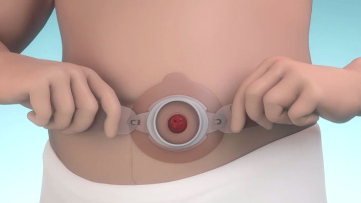 How to use Brava Belt